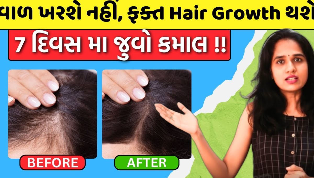 વાળ ખરતા રોકવા માટે ઘરેલુ ઉપાય